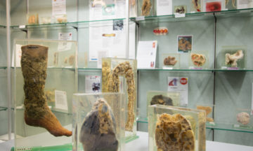 Learn about some of Australia’s biggest killers at the Museum of Human Disease